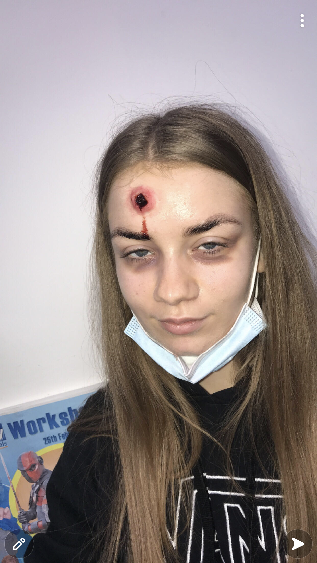 Special effects bullet hole wound and bruising